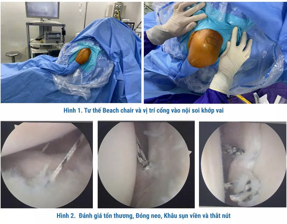 Ảnh: Báo Sức khỏe & Đời sống